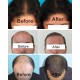 Premier Hair Care Program
